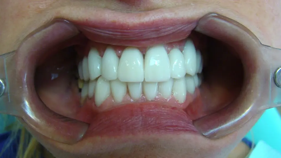 after-image